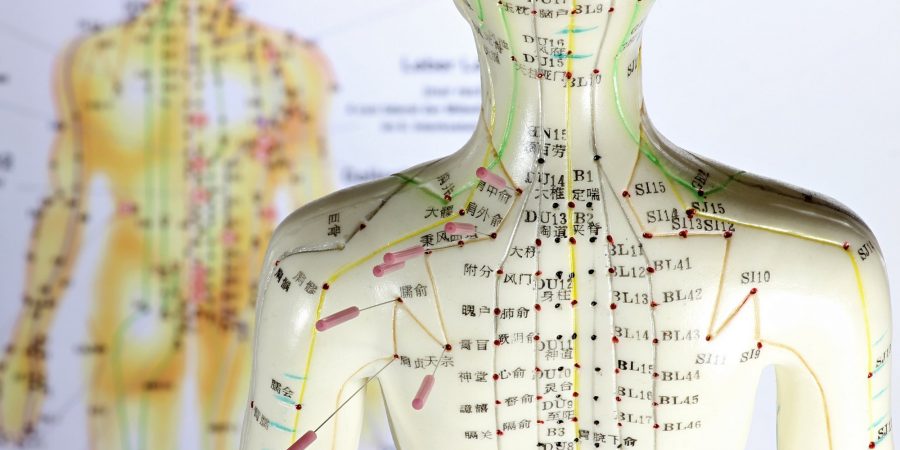 weibliches Akupunkturmodell mit Nadeln im Schulterbereich vor Le